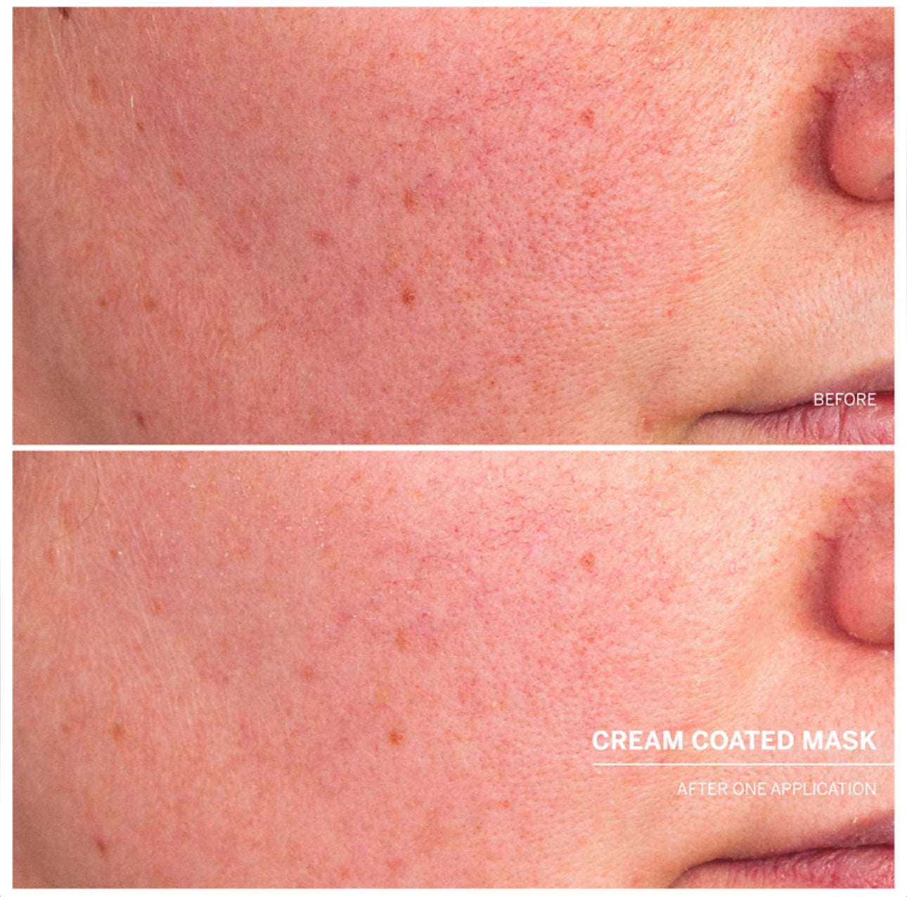 Dr. Babor Cream Coated Calming Sheetmask
Lindrende intensiv hudpleiemaske for tørr, sensitiv og stresset hud.